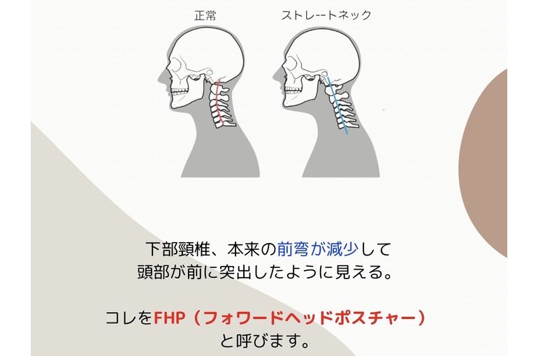 姿勢改善