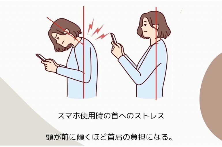 首こり　首痛